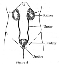 catheter figA